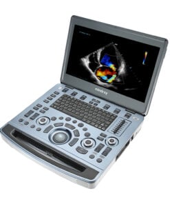 Handheld elective ultrasound equipment for sale