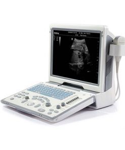 Portable 4D ultrasound machines for sale