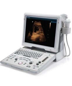 Elective ultrasound equipment suppliers in the U.S.