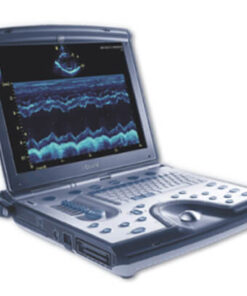 High-definition 3D ultrasound equipment for keepsake studios