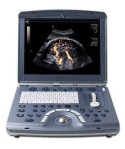 Portable elective ultrasound machines with Doppler