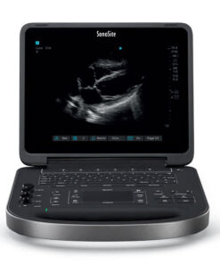 Elective ultrasound equipment package deals for startups