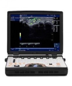 How to buy used ultrasound equipment for elective imaging