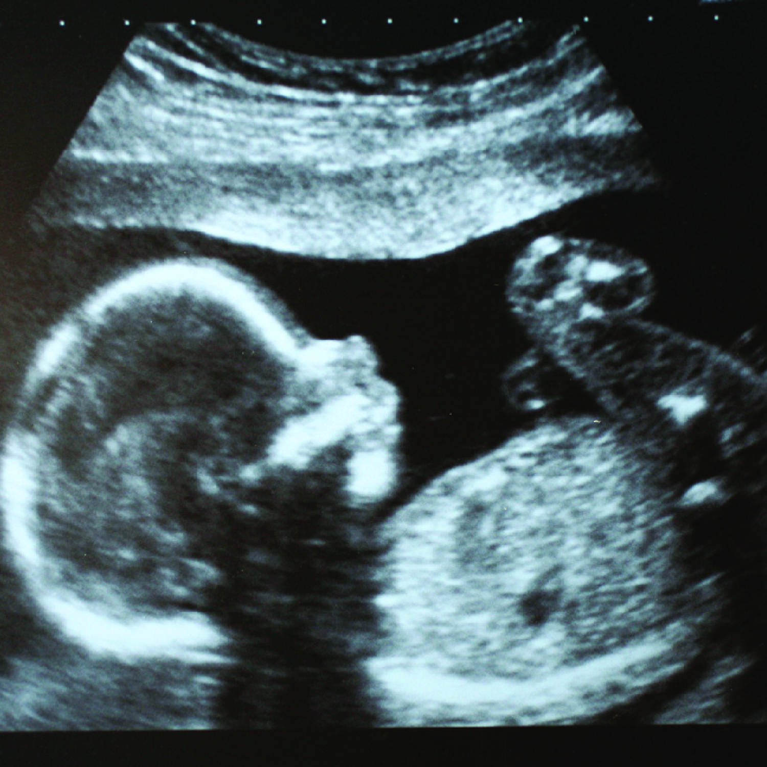 Online elective ultrasound training with certification