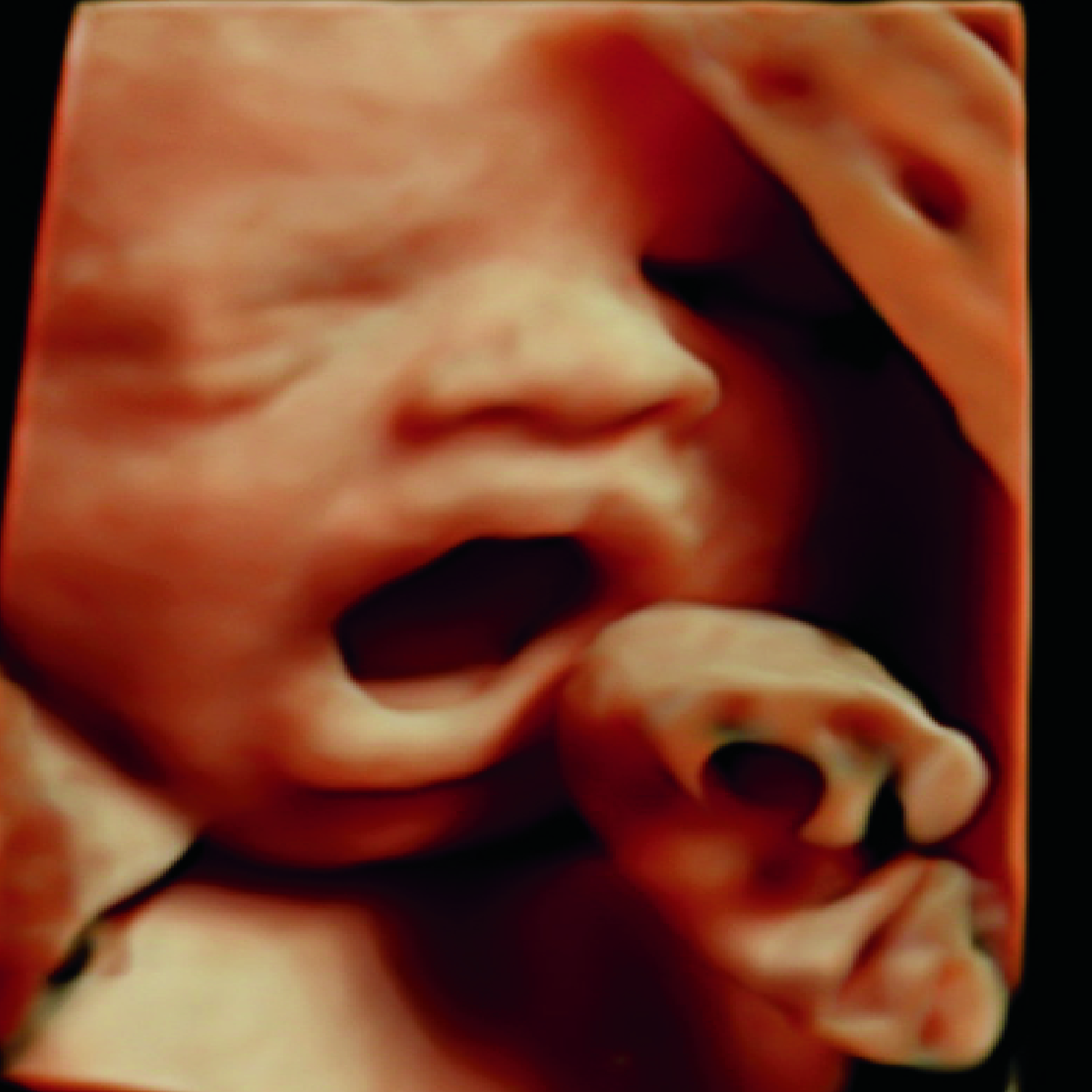 How to become a certified elective ultrasound technician