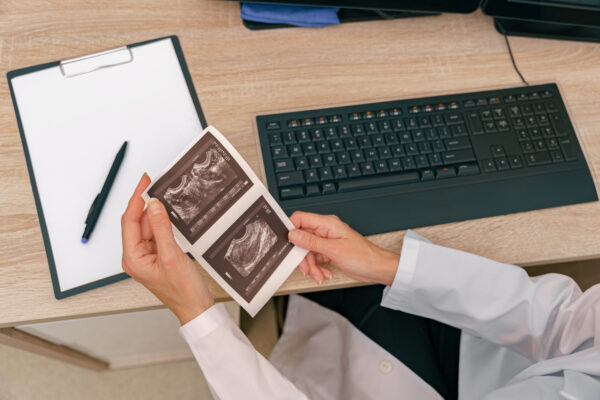 The Science Behind 3D and 4D Ultrasounds