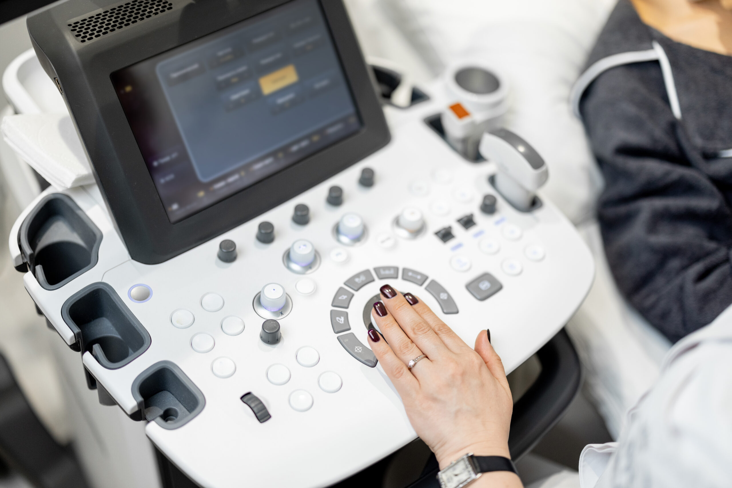 3D 4D HD elective ultrasound machine console close-up during Scotland training session