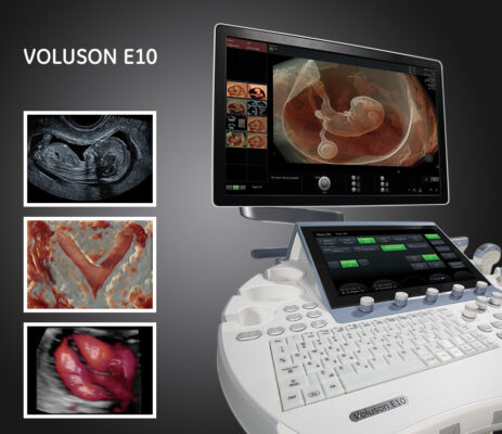 Explore how the GE Voluson E10 elevates 4D/HD ultrasound studios with superior imaging, expert insights, and proven business advantages.