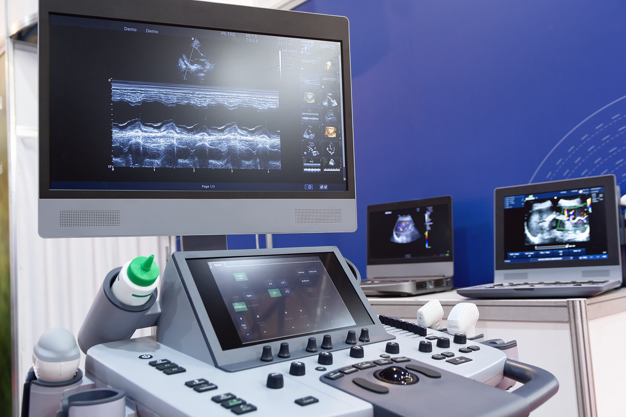 Best 4D Ultrasound Machines for Sale (2025 Guide): HD/5D Systems ...