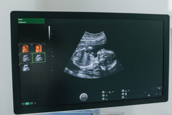 Explore the best HD/5D keepsake ultrasound machines, investment costs, expert training, and proven marketing tactics to launch a profitable 3D/4D elective ultrasound business in 2025.