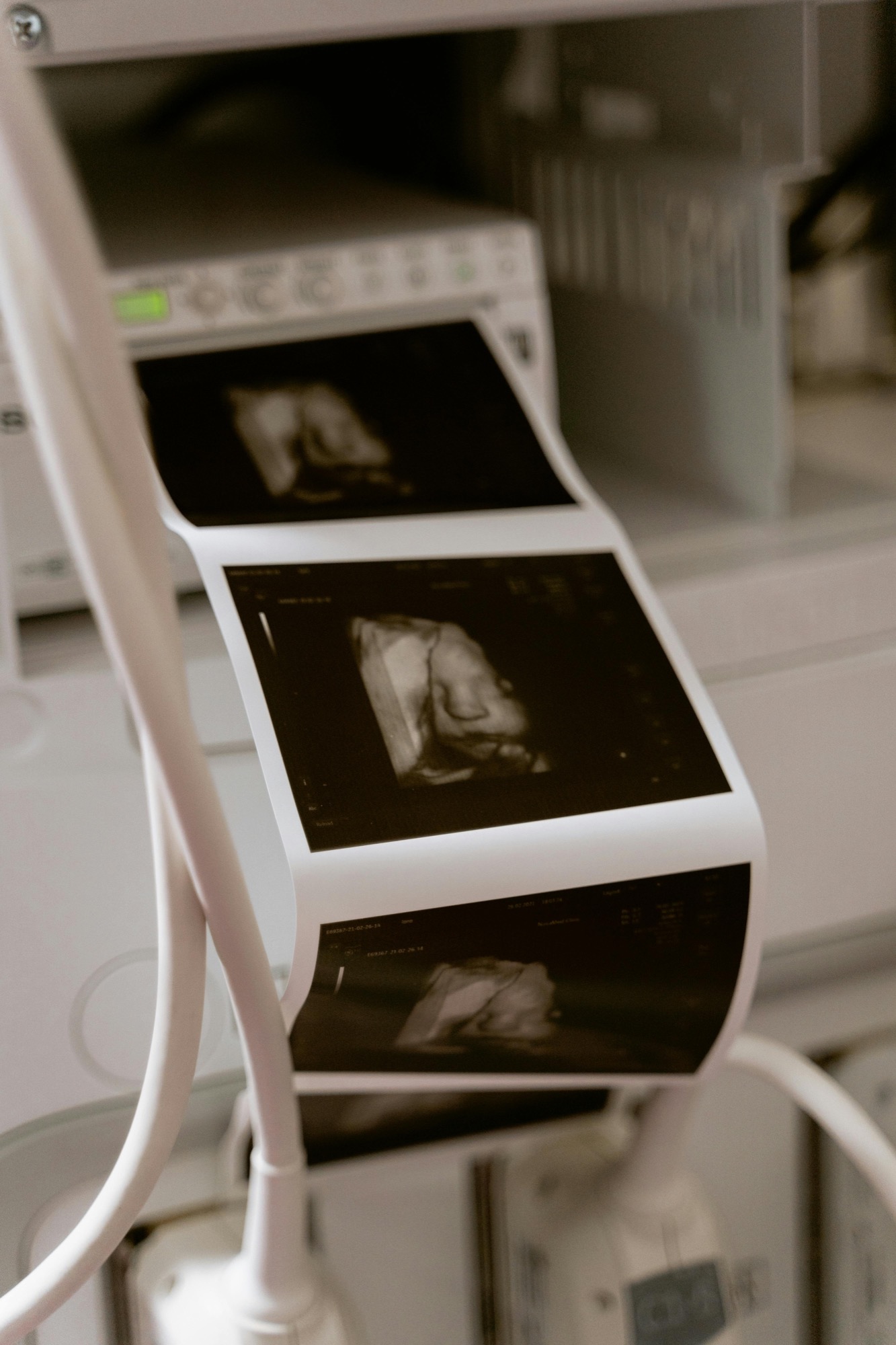 Ultrasound machine showing printer with 4D keepsake prints