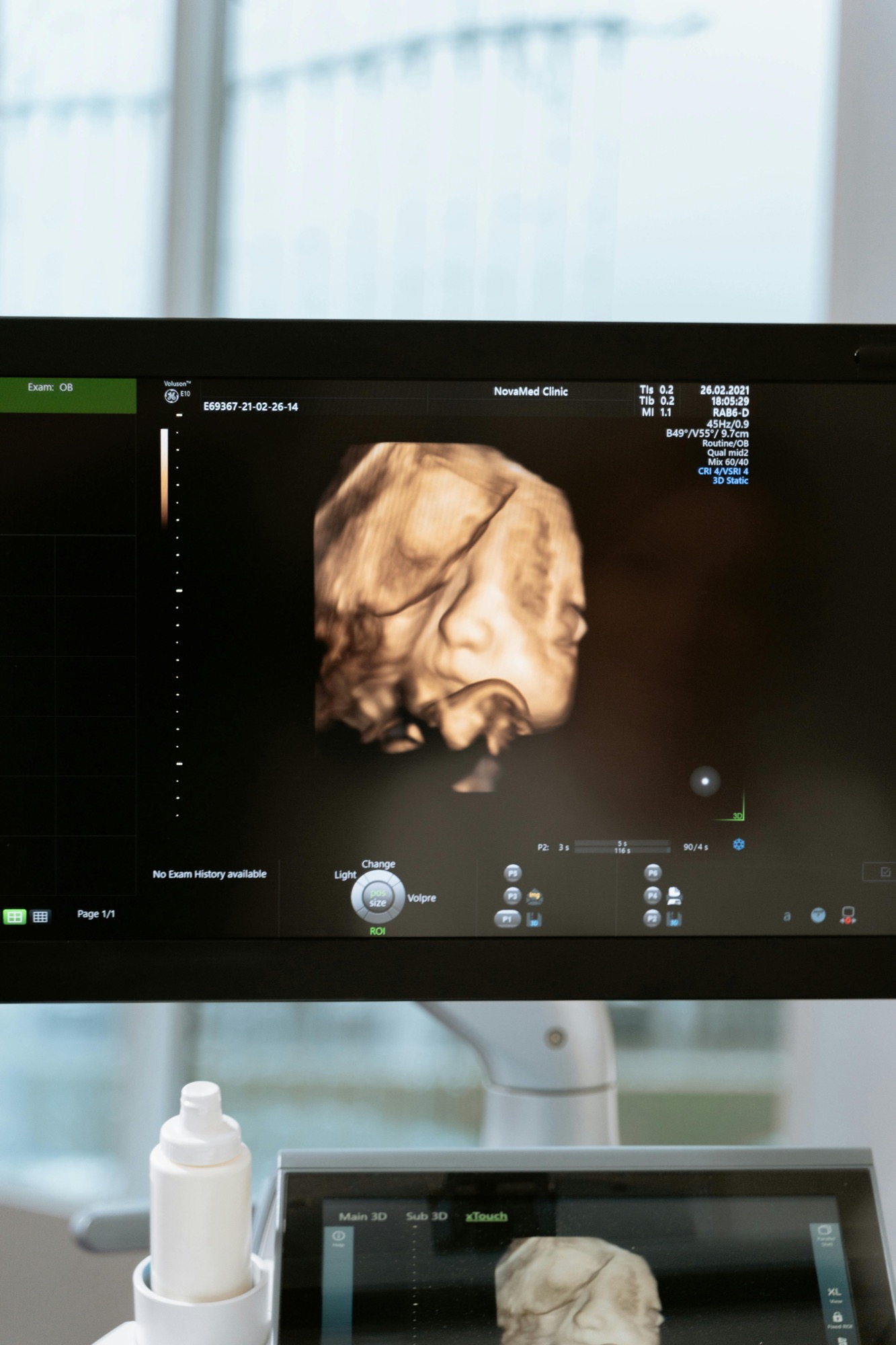 Ultrasound machine monitor displaying 4D HDLive baby image during Wales training