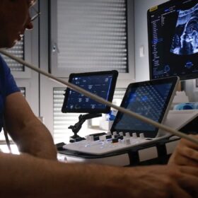 Compare GE HDLive, Philips TrueVue, and Samsung Crystal Vue 4D scans to see which rendering delights parents and increases bookings at your ultrasound studio.