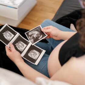 Elective Ultrasound Training