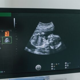 Elective Ultrasound Training