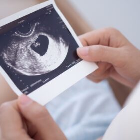 Elective Ultrasound Training