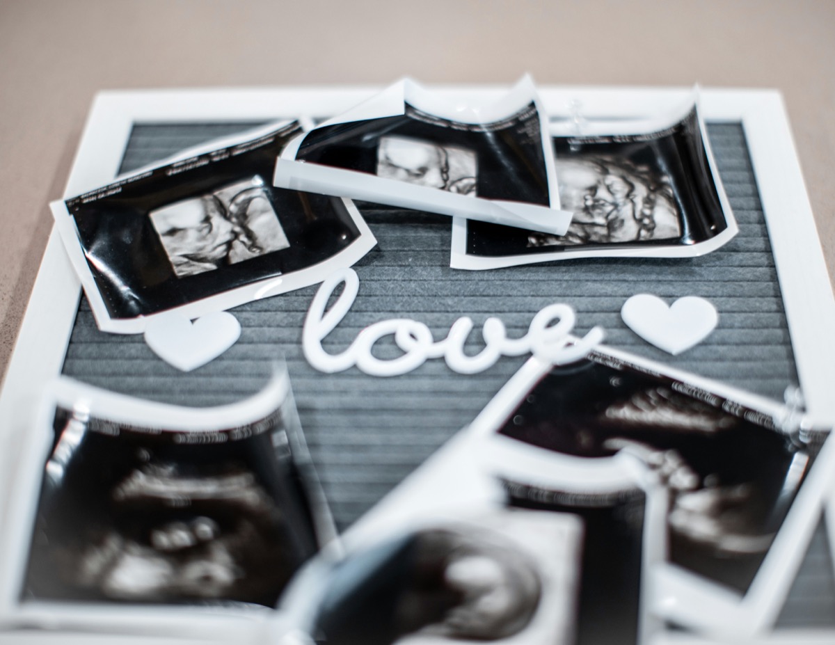 Pile of 4D ultrasound keepsake prints from Western Australia studio